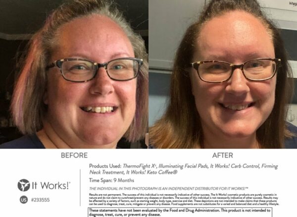 233555 before and after thermofight xx illuminating facial pads it works carb control firming neck tratment it works keto coffee us en